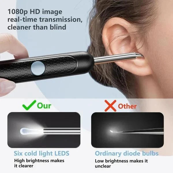 PureEase™ Smart Visual Ear Cleaner (1080P HD Camera + LED Light)