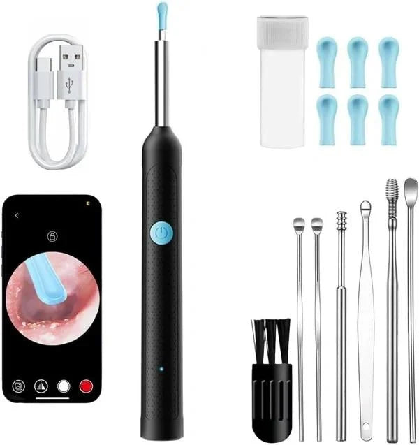 PureEase™ Smart Visual Ear Cleaner (1080P HD Camera + LED Light)