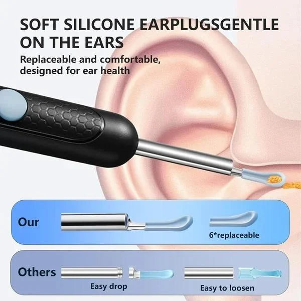 PureEase™ Smart Visual Ear Cleaner (1080P HD Camera + LED Light)