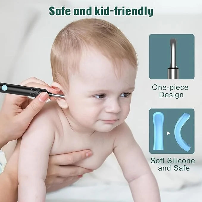 PureEase™ Smart Visual Ear Cleaner (1080P HD Camera + LED Light)